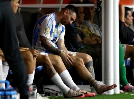 Así quedó el tobillo de Messi tras salir de la final de la Copa América imagen-10