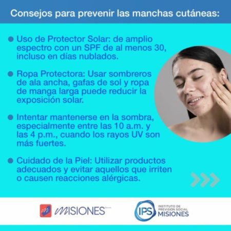 IPS EDUCA: 💥¿Qué son las manchas cutáneas y qué las causa? 🌞🌼 imagen-7