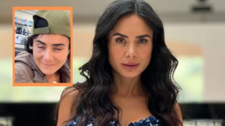 Johanna Fadul se burló de las críticas que recibió por los moretones en su rostro: “¿Quién le dio en la jeta?” imagen-12