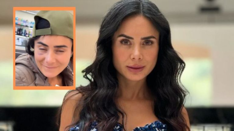 Johanna Fadul se burló de las críticas que recibió por los moretones en su rostro: “¿Quién le dio en la jeta?” imagen-4