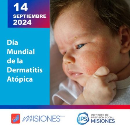 🗒️14 de septiembre I 🌏 Día Mundial de la Dermatitis Atópica imagen-10