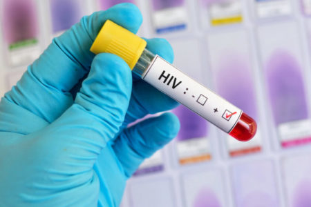 Ya no hay límites para la crueldad: el Gobierno recorta los fondos para pacientes con HIV imagen-7