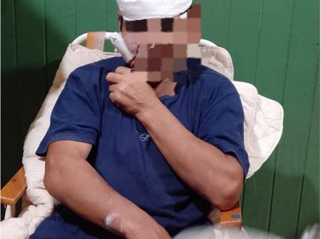 Hombre de 63 años atropellado por una moto en el barrio Las Leñas: familiares piden testigos imagen-10