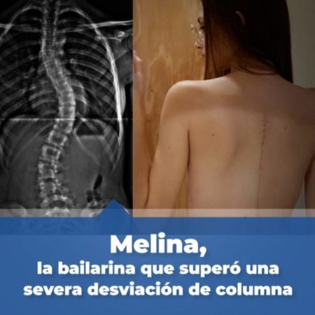 ✨👧🏻Esta es la increíble historia de recuperación de Melina (16), una joven bailarina y modelo! imagen-13