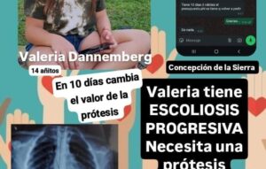 Valeria necesita una prótesis de más de 3 millones de pesos para poder operarse imagen-2