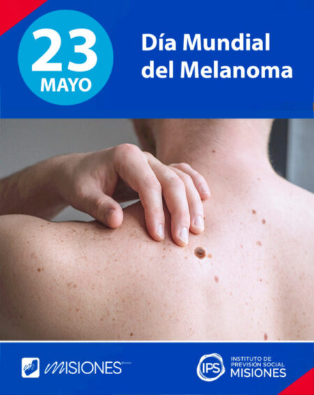 🖤 Día Mundial del Melanoma: 🗓️ 23 de mayo imagen-16