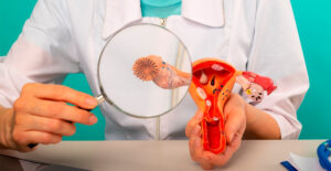 El 70% de los casos de cáncer de ovarios se detecta en estadios avanzados: cómo prevenir imagen-1