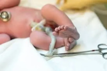 Donación de sangre de cordón umbilical, una herramienta clave para trasplantes de médula imagen-21