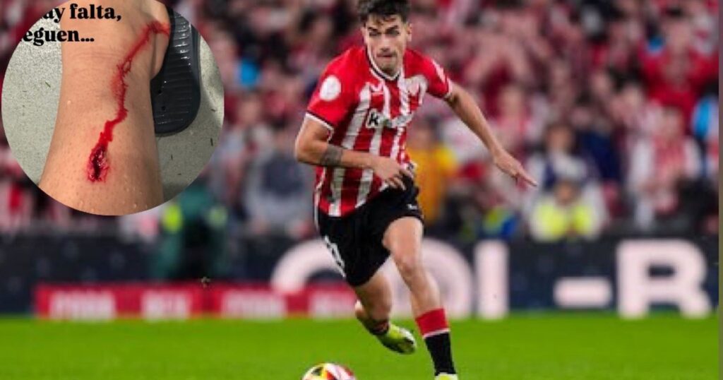 La impactante herida que sufrió un jugador del Bilbao en las semifinales ante el Manchester United imagen-42