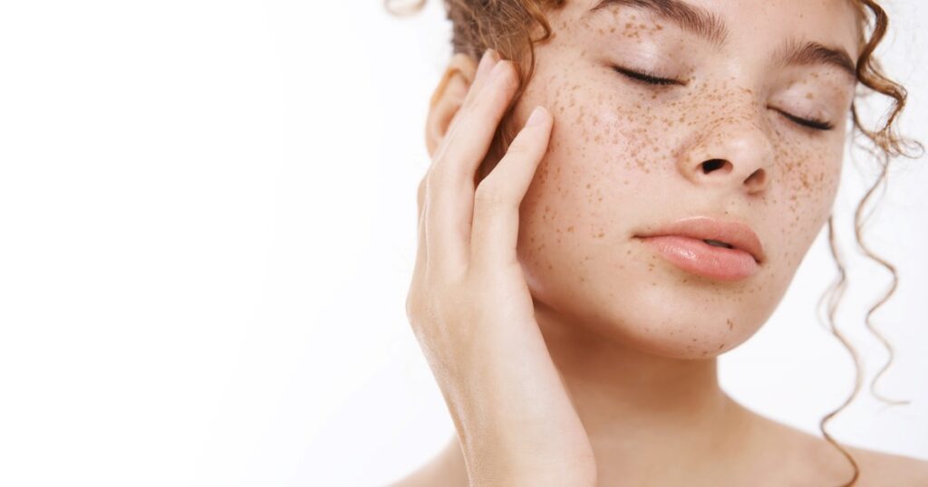 Piel perfecta para este invierno: Como quedar libre de manchas y que tratamientos realizar para prevenirlas imagen-4
