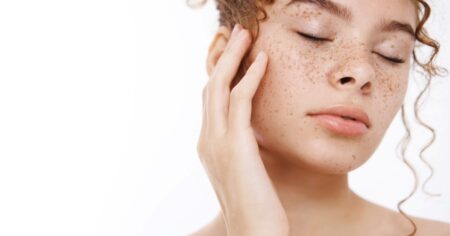Piel perfecta para este invierno: Como quedar libre de manchas y que tratamientos realizar para prevenirlas imagen-12