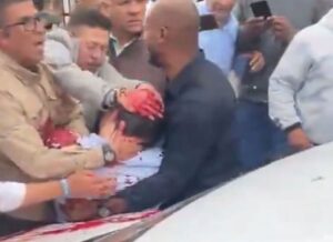 Atacaron al senador Miguel Uribe Turbay en Colombia: le dispararon por la espalda en un acto imagen-1