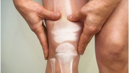 Los 6 antiinflamatorios naturales que se pueden usar para terminar con el dolor de rodilla imagen-17