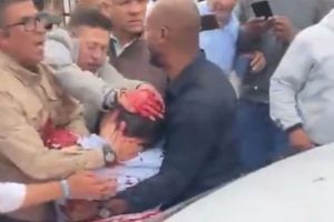 Colombia | El precandidato a presidente Miguel Uribe Turbay fue operado tras recibir tres disparos y enfrenta “horas críticas” imagen-7
