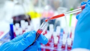 La ciencia argentina da un paso clave en la lucha contra el VIH con respaldo de la OMS imagen-7