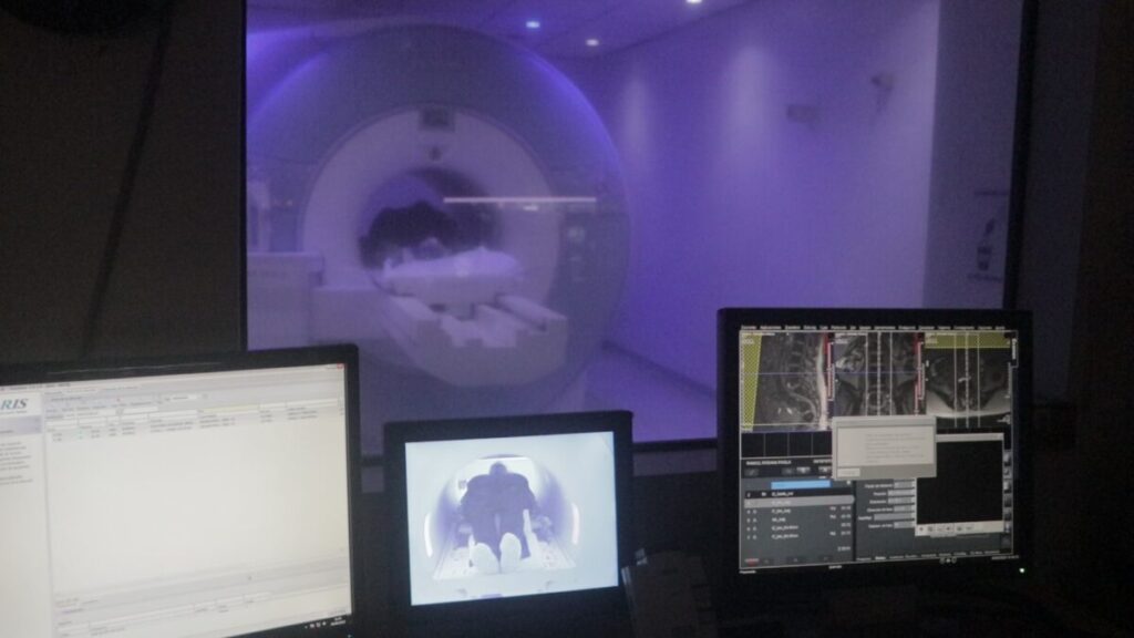 El Madariaga innova con terapia celulares y realiza los 2 primeros trasplantes haploidénticos de células de los propios pacientes imagen-5