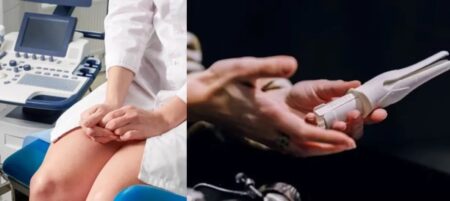 Diseñan un nuevo espéculo vaginal que promete hacer menos incómodos los exámenes ginecológicos imagen-7