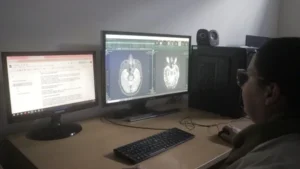 El hospital Madariaga realiza cirugías contra la epilepsia severa: registraron 14 pacientes en los últimos años imagen-2