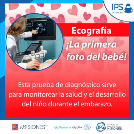 👶✨ La ecografía: una ventana al corazón de tu embarazo ✨👶 imagen-5