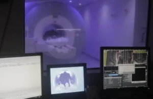 Desde el Madariaga alertan sobre los riesgos del ACV y la importancia de actuar a tiempo imagen-1