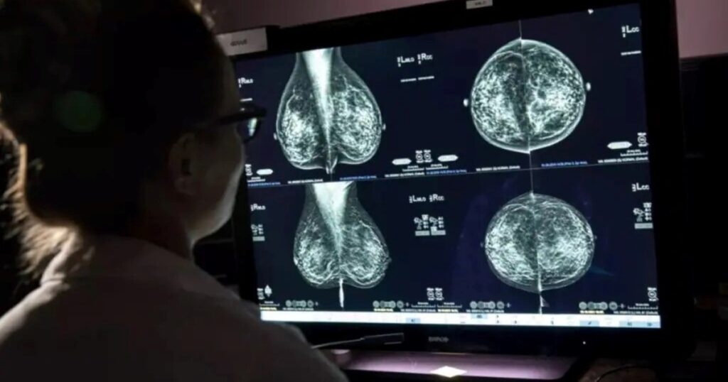 El Oeste se tiñe de rosa en el mes de la Sensibilización sobre el Cáncer de Mama imagen-94
