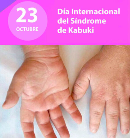 📒23 de octubre: Dia del Síndrome de Kabuki 📒23 de octubre: Dia del Síndrome de Kabuki imagen-6