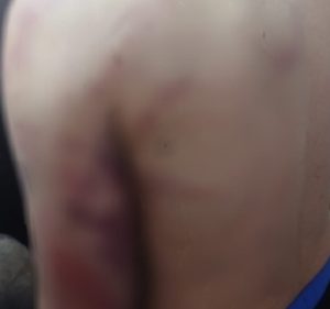 Golpeó brutalmente a su hijo y ahora es intensamente buscado por la Policía en Posadas Golpeó brutalmente a su hijo y ahora es intensamente buscado por la Policía en Posadas imagen-6
