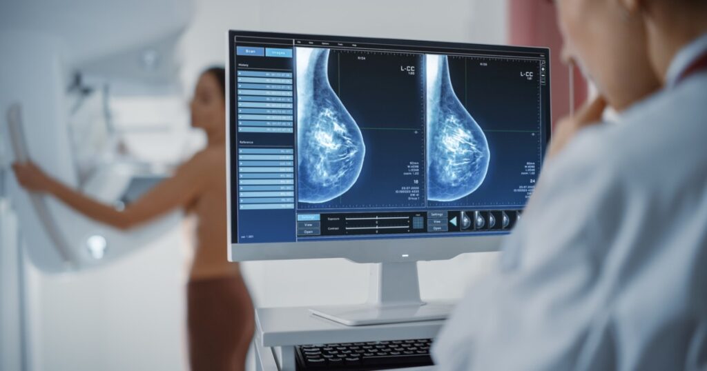 Cambian la edad a partir de la cual las mujeres bonaerenses deben hacerse la mamografía contra el cáncer de mama imagen-5