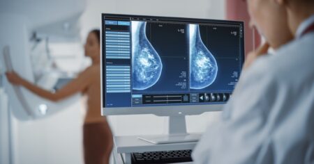 Cambian la edad a partir de la cual las mujeres bonaerenses deben hacerse la mamografía contra el cáncer de mama imagen-7
