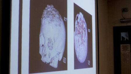 Neurocirugía y Cirugía Plástica abordan patologías complejas en el Hospital Madariaga imagen-12