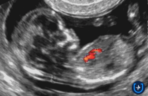 El Programa Nacional de Cardiopatías Congénitas seguirá vigente, pero Nación despidió a los profesionales más expertos imagen-10