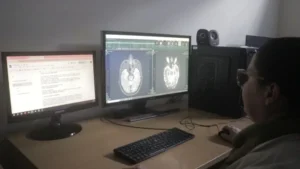 El Madariaga innovó con la cirugía de Epilepsia y terapias alternativas imagen-1