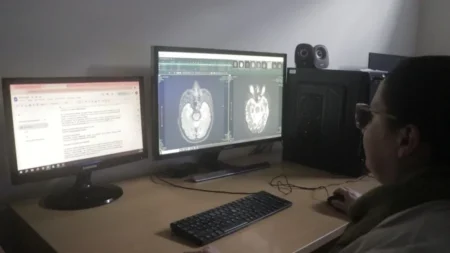 El Madariaga innovó con la cirugía de Epilepsia y terapias alternativas imagen-4