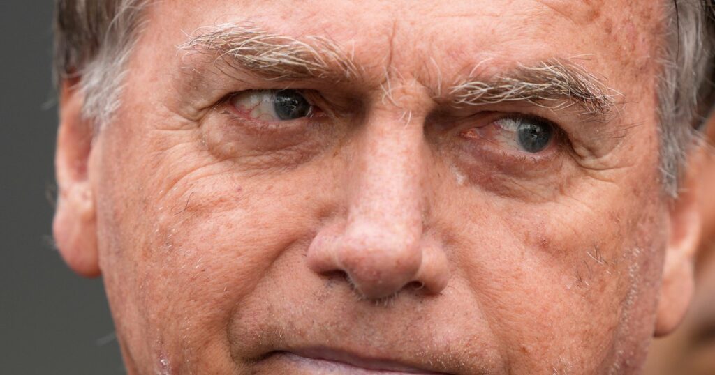 Jair Bolsonaro tuvo una mejoría renal, pero sigue en terapia intensiva: qué dice el parte médico de hoy imagen-99