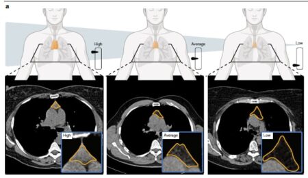 El pequeño órgano que se daba por terminado y que ahora aparece ligado al riesgo de muerte y enfermedad imagen-8