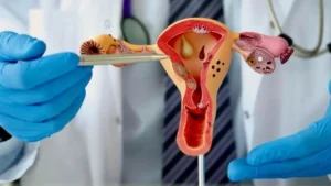 Día Mundial de la Endometriosis: entre el 50% y el 70% de las mujeres pueden lograr un embarazo espontáneo imagen-1