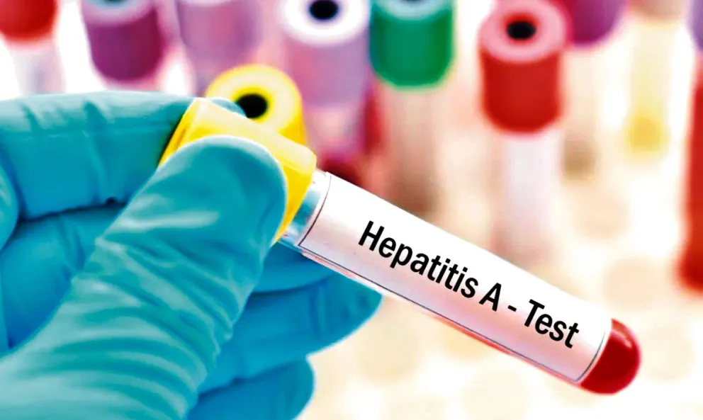 Misiones no registró casos de hepatitis A el año pasado Misiones no registró casos de hepatitis A el año pasado imagen-4