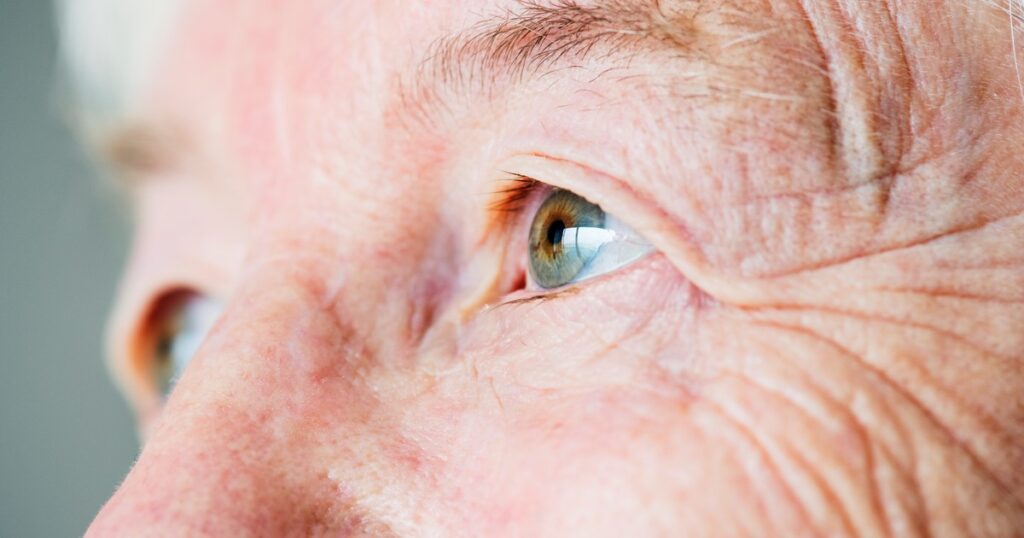 Colesterol alto: las señales que pueden verse en los ojos Colesterol alto: las señales que pueden verse en los ojos imagen-100