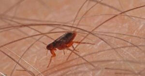 Alerta en California: el tifus transmitido por pulgas alcanza niveles récord y preocupa a las autoridades Alerta en California: el tifus transmitido por pulgas alcanza niveles récord y preocupa a las autoridades imagen-3