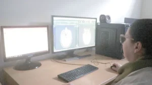 Parkinson: señales tempranas, evolución, diagnóstico y tratamiento Parkinson: señales tempranas, evolución, diagnóstico y tratamiento imagen-1