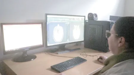 Parkinson: señales tempranas, evolución, diagnóstico y tratamiento imagen-12