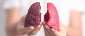 Misiones registró dos casos de fibrosis quística en 2025 y destacan avances en tratamientos imagen-1