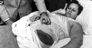 Solo una persona en toda la historia fue golpeada por un meteorito: quién fue y qué le pasó después imagen-2