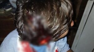 Violenta agresión en el barrio San Onofre: un hombre terminó hospitalizado Violenta agresión en el barrio San Onofre: un hombre terminó hospitalizado imagen-2