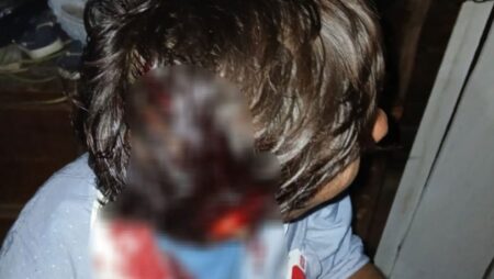 Violenta agresión en el barrio San Onofre: un hombre terminó hospitalizado Violenta agresión en el barrio San Onofre: un hombre terminó hospitalizado imagen-6