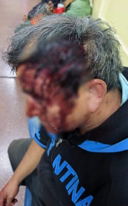 Una pelea vecinal terminó con un hombre herido en la cabeza en Posadas imagen-14