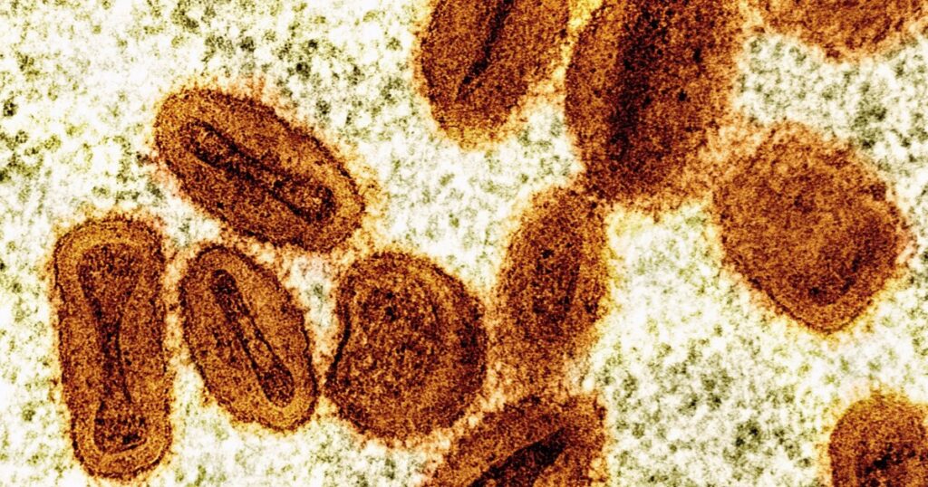 Acusan a dos científicos de introducir de contrabando virus de mpox desactivado en Estados Unidos y mentir a las autoridades imagen-98