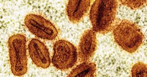 Acusan a dos científicos de introducir de contrabando virus de mpox desactivado en Estados Unidos y mentir a las autoridades imagen-3