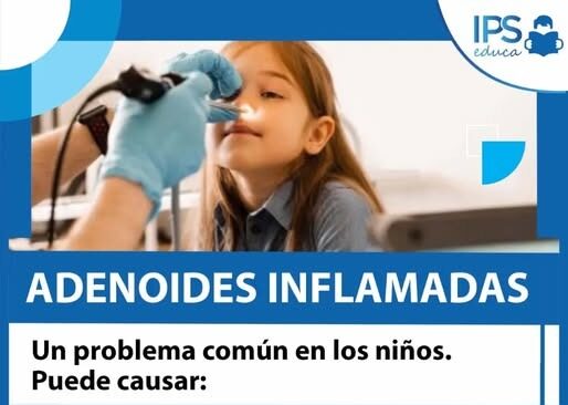 👃 ¿Adenoides inflamadas? Prestá atención a estos síntomas 👃 ¿Adenoides inflamadas? Prestá atención a estos síntomas imagen-5