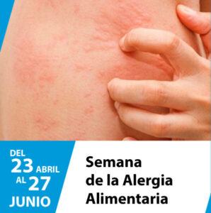 23 al 27 de junio: 🥜🥛🍳 Semana de la Alergia Alimentaria 23 al 27 de junio: 🥜🥛🍳 Semana de la Alergia Alimentaria imagen-1